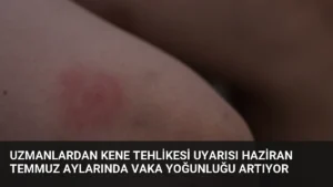 Uzmanlardan Kene Tehlikesi Uyarısı Haziran Temmuz Aylarında Vaka Yoğunluğu Artıyor