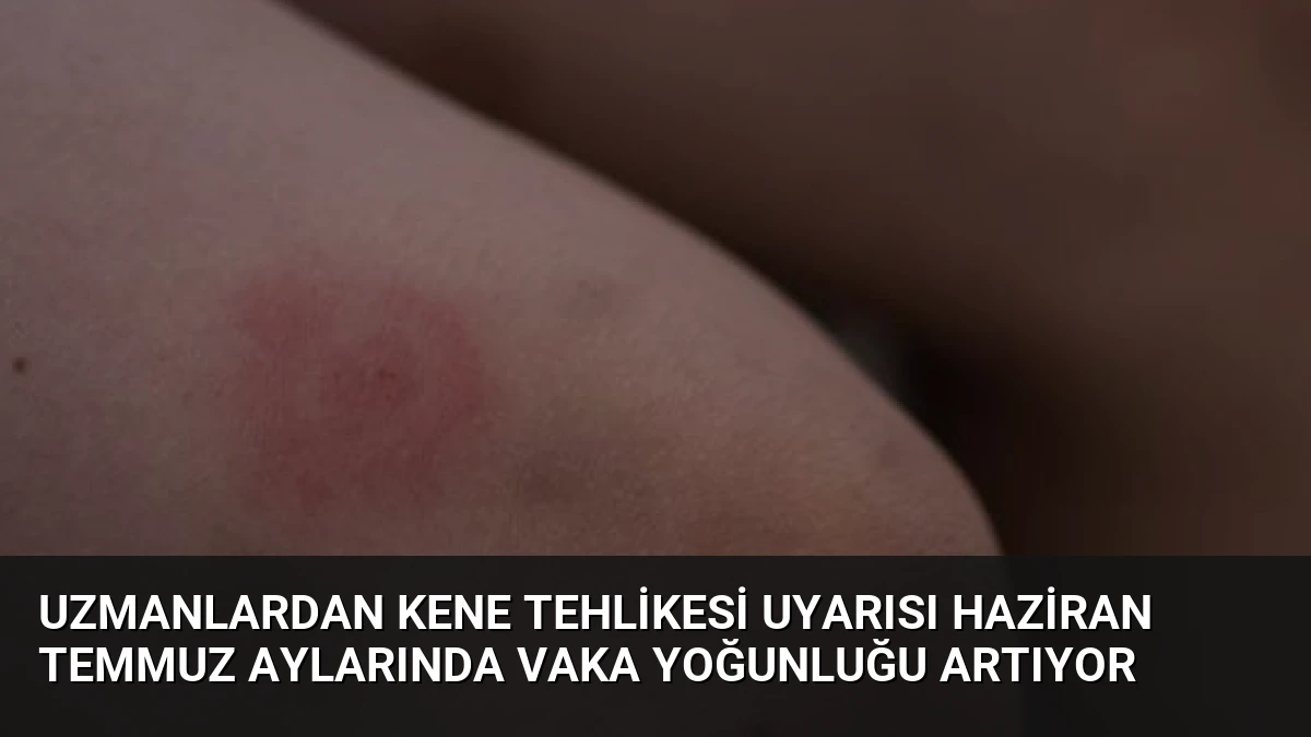 Uzmanlardan Kene Tehlikesi Uyarısı Haziran Temmuz Aylarında Vaka Yoğunluğu Artıyor